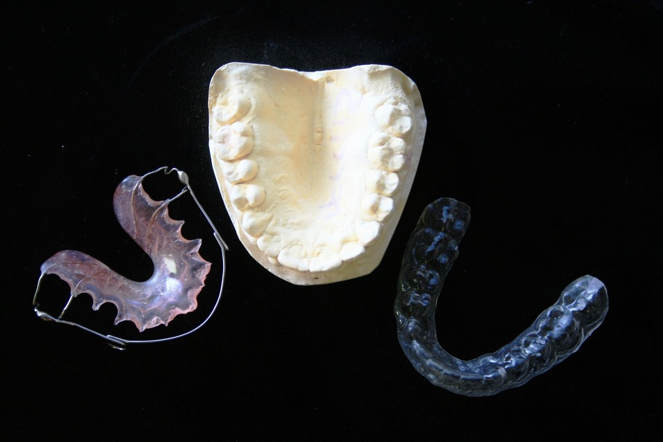 Mondbitjes