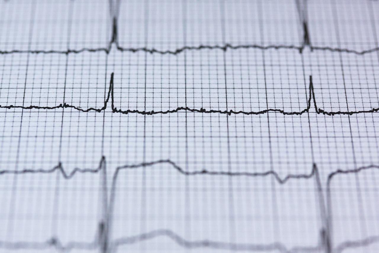 ecg gcfc2fc52b 1280 hartslag